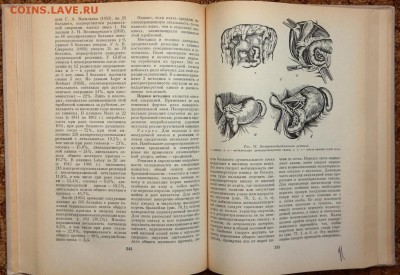 "Хирургия печени и желчных протоков" 1975г. - SAM_1401.JPG