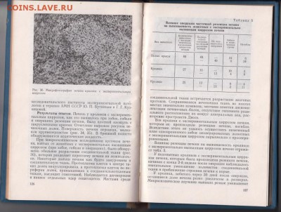 Регенерация печени 1980 г. до 27.07.19 г. в 23.00 - 004
