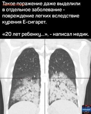 Электронные сигареты помогает бросить курить или нет? - 2nxDztERCh4