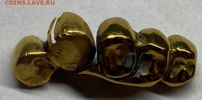 Зубные коронки - image-21-03-22-04-31-1