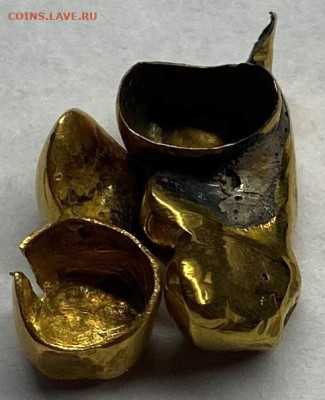 Зубные коронки - image-21-03-22-04-31