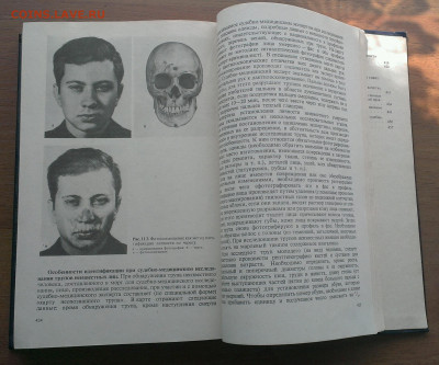 Судебная медицина ,до 22.7.22г в 22:00 по мск - IMAG3927_1