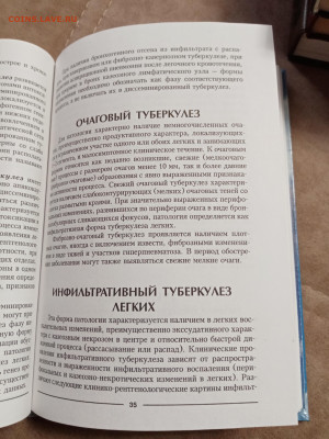 Туберкулез лечение и профилактика. До 10.05.25 в 22:00 по мс - IMG_20250504_112151