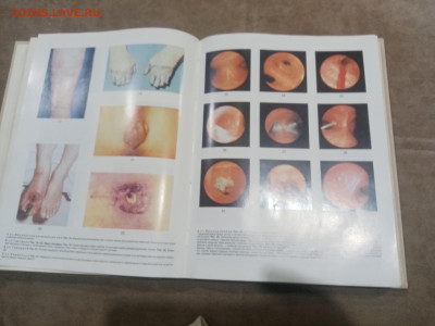 Краткая медицинская энциклопедия в 3х томах до 12.02.26 в 22 - IMG_20260207_004111