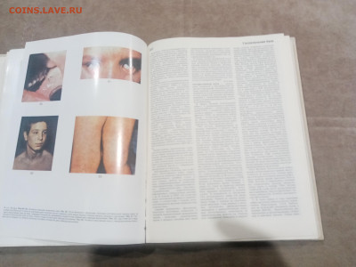 Краткая медицинская энциклопедия в 3х томах до 12.02.26 в 22 - IMG_20260207_004055