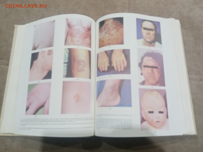 Краткая медицинская энциклопедия в 3х томах до 12.02.26 в 22 - IMG_20260207_004009