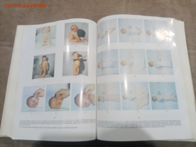 Краткая медицинская энциклопедия в 3х томах до 12.02.26 в 22 - IMG_20260207_003845