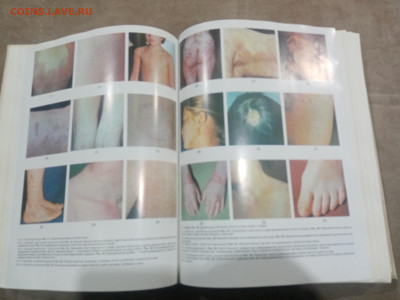 Краткая медицинская энциклопедия в 3х томах до 12.02.26 в 22 - IMG_20260207_003836