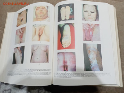 Краткая медицинская энциклопедия в 3х томах до 26.02.26 в 22 - IMG_20260220_214231