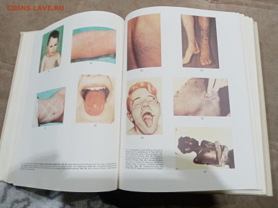 Краткая медицинская энциклопедия в 3х томах до 26.02.26 в 22 - IMG_20260220_214222