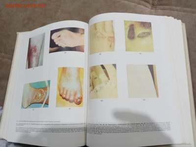 Краткая медицинская энциклопедия в 3х томах до 26.02.26 в 22 - IMG_20260220_214209