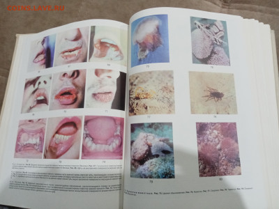 Краткая медицинская энциклопедия в 3х томах до 26.02.26 в 22 - IMG_20260220_214149