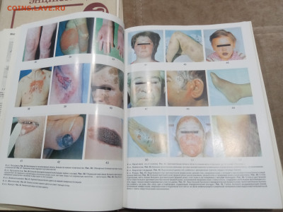 Краткая медицинская энциклопедия в 3х томах до 07.03.26 в 22 - IMG_20260302_021954