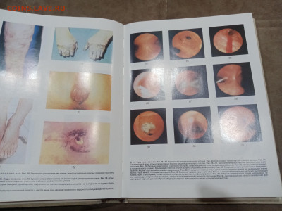 Краткая медицинская энциклопедия в 3х томах до 07.03.26 в 22 - IMG_20260302_021907