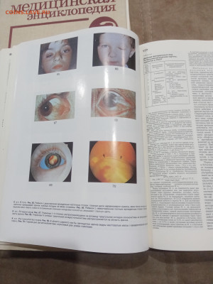 Краткая медицинская энциклопедия в 3х томах до 07.03.26 в 22 - IMG_20260302_021533