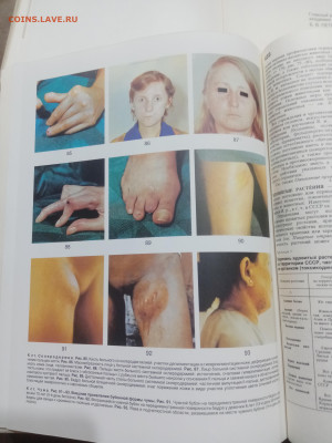 Краткая медицинская энциклопедия в 3х томах до 07.03.26 в 22 - IMG_20260302_021407